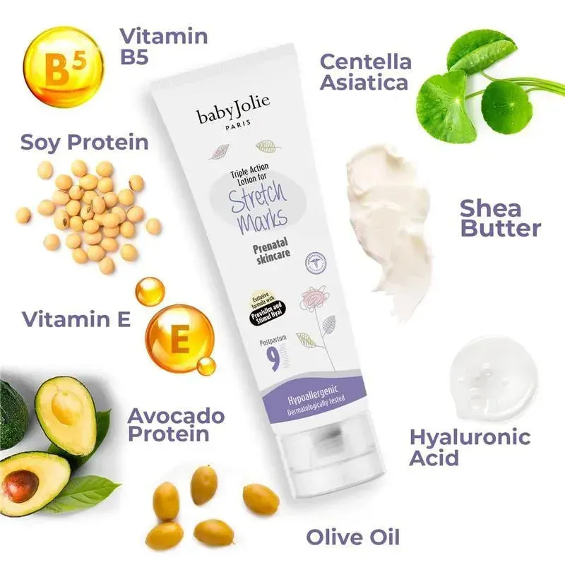 Baby Jolie - Mom Care Postpartum Set (Restructuring Gel & Stretch Marks) - Image 3