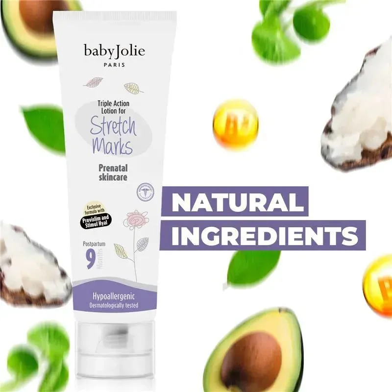 Baby Jolie - Mom Care Postpartum Set (Restructuring Gel & Stretch Marks) - Image 8