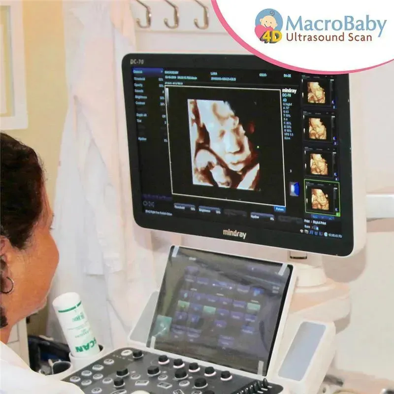 Macrobaby 4D Ultrasound Packages - Gold & 8K - Image 2
